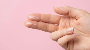 Leucorrhoea Explained: What Normal Vaginal Discharge Looks Like