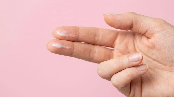 Leucorrhoea Explained: What Normal Vaginal Discharge Looks Like