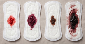 Blood Clots During Periods: What's Normal and When Should You Worry?